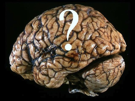 brain ?